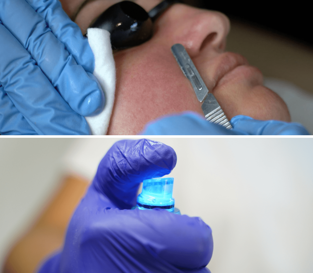 traitement cutané hydrafacial et dermaplaning